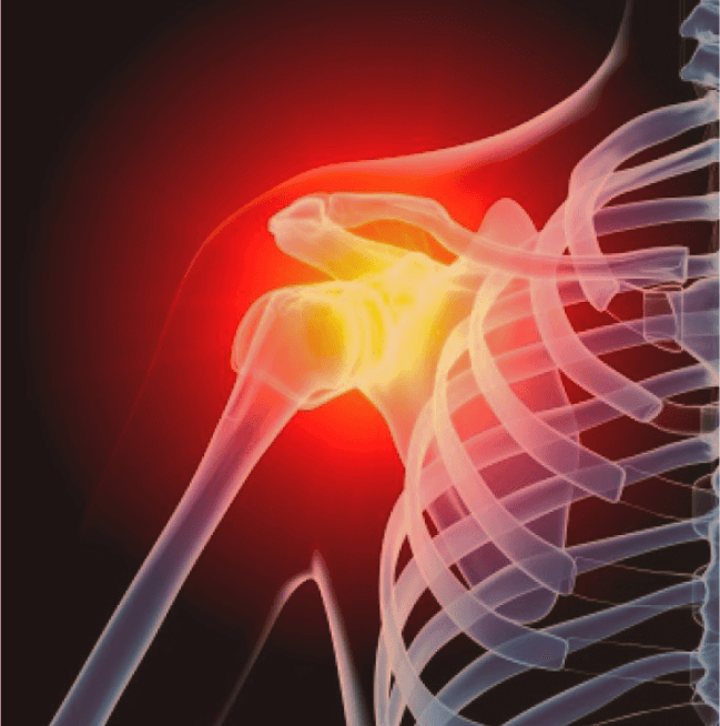 YELKA uchun mashqlar